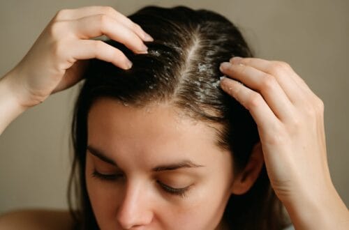 skora g owy t usta regulacja sebum peelingi 1
